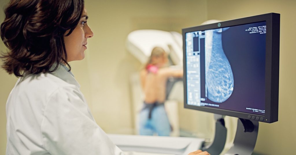 Tyrer-Cuzick breast cancer assessment - Capitol Imaging Services