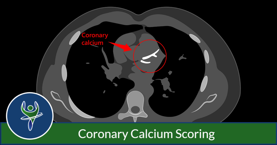 Coronary calcium scoring