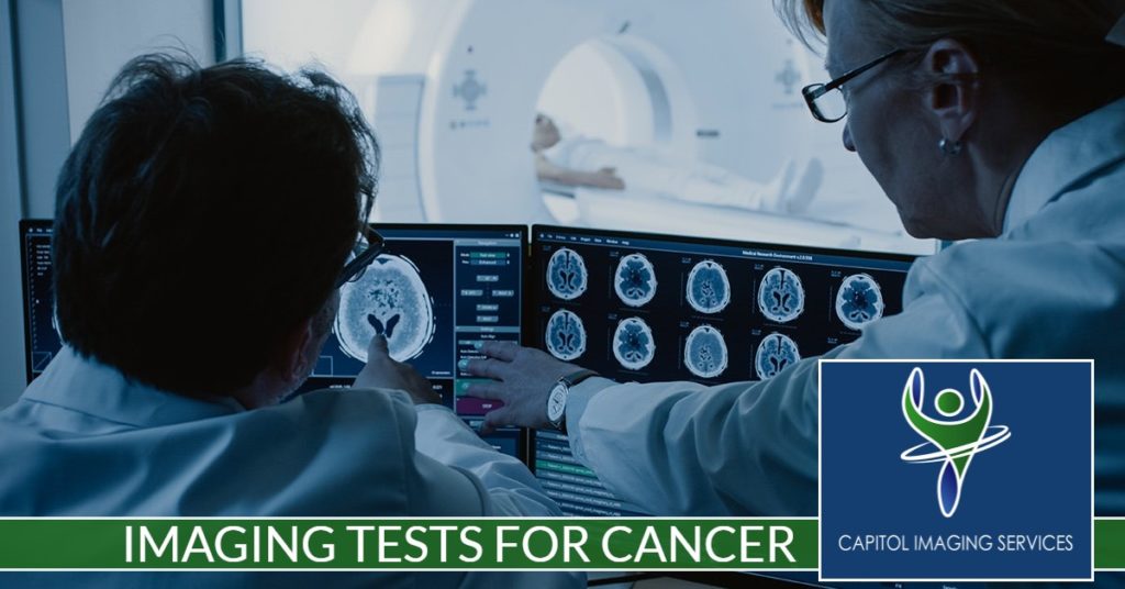 Imaging Tests for Cancer Capitol Imaging Services