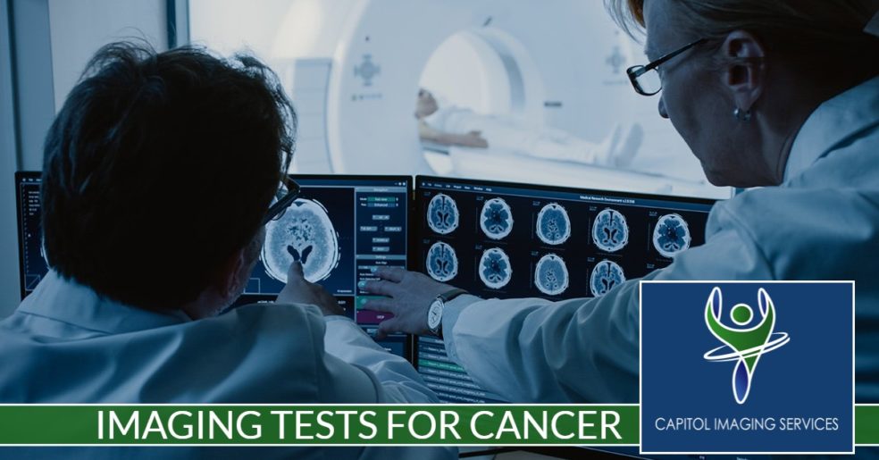 Imaging Tests for Cancer