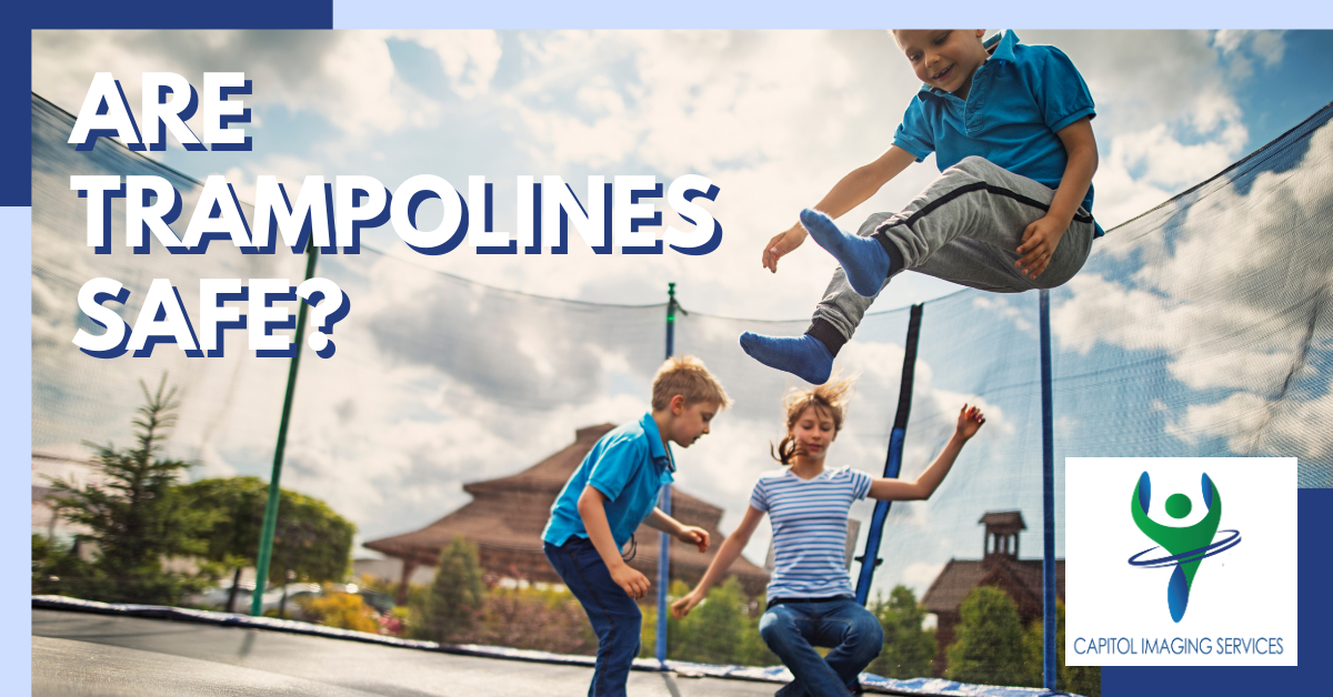 Are Trampolines Safe? - Capitol Imaging Services