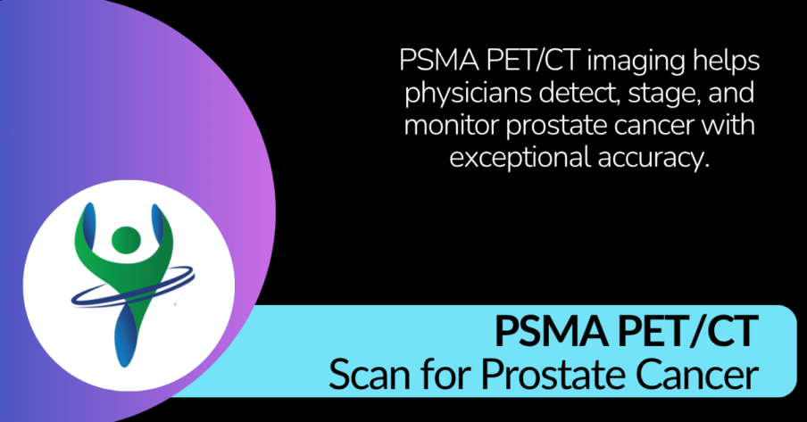PSMA PETCT Scan for Prostate Cancer